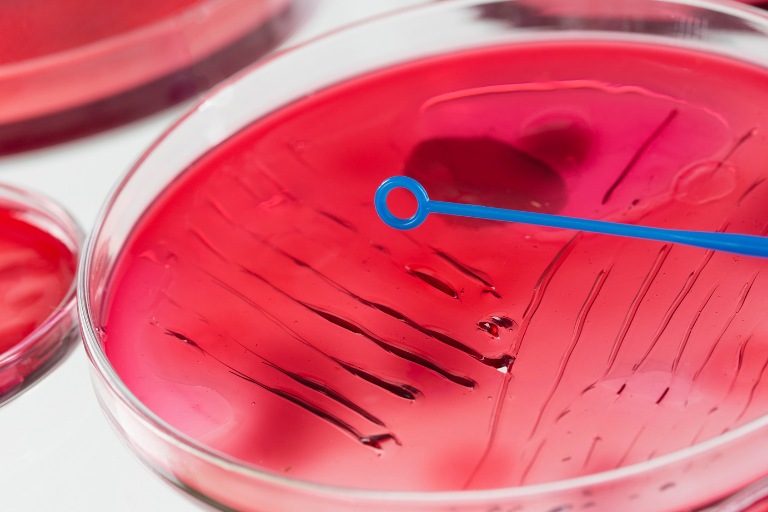 Challenge Tests et nouveau référentiel