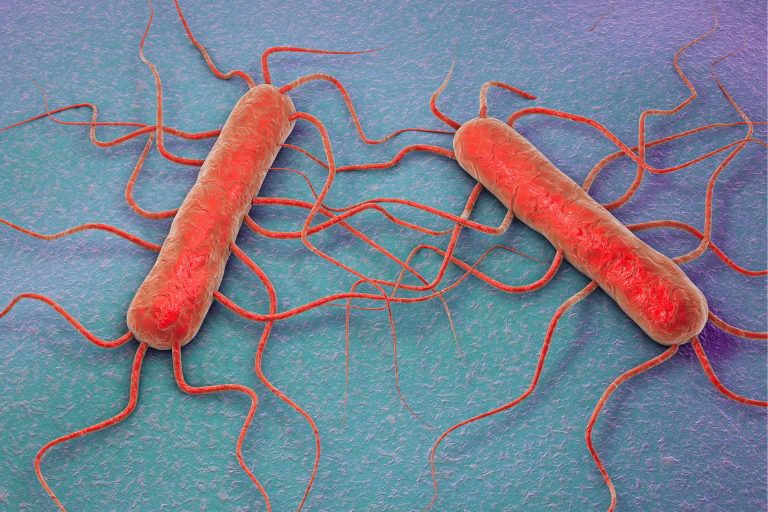 Origine de la contamination de Listeria