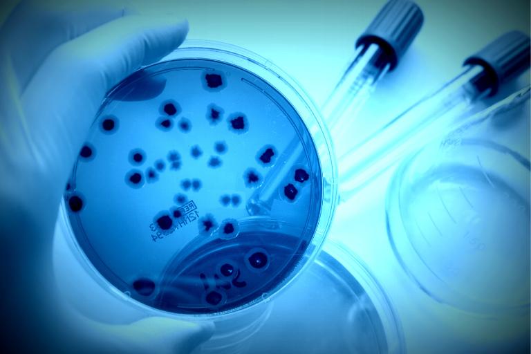 Microbio. prévisionnelle >Challenge Test