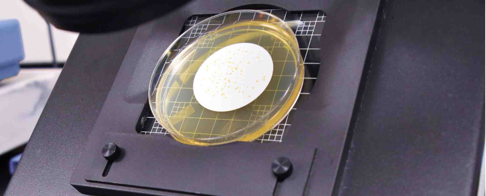 Bioburden testing Banner